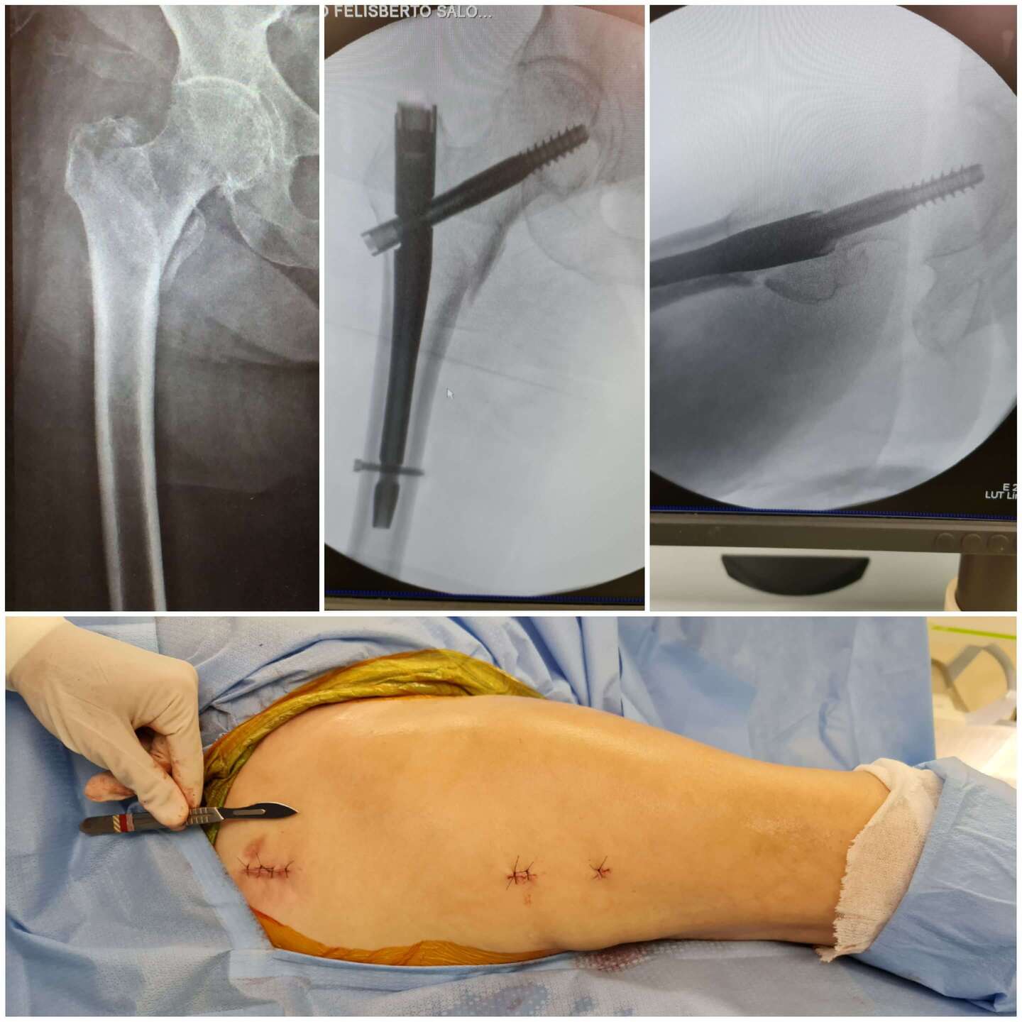 cirurgia-minimamente-invasiva