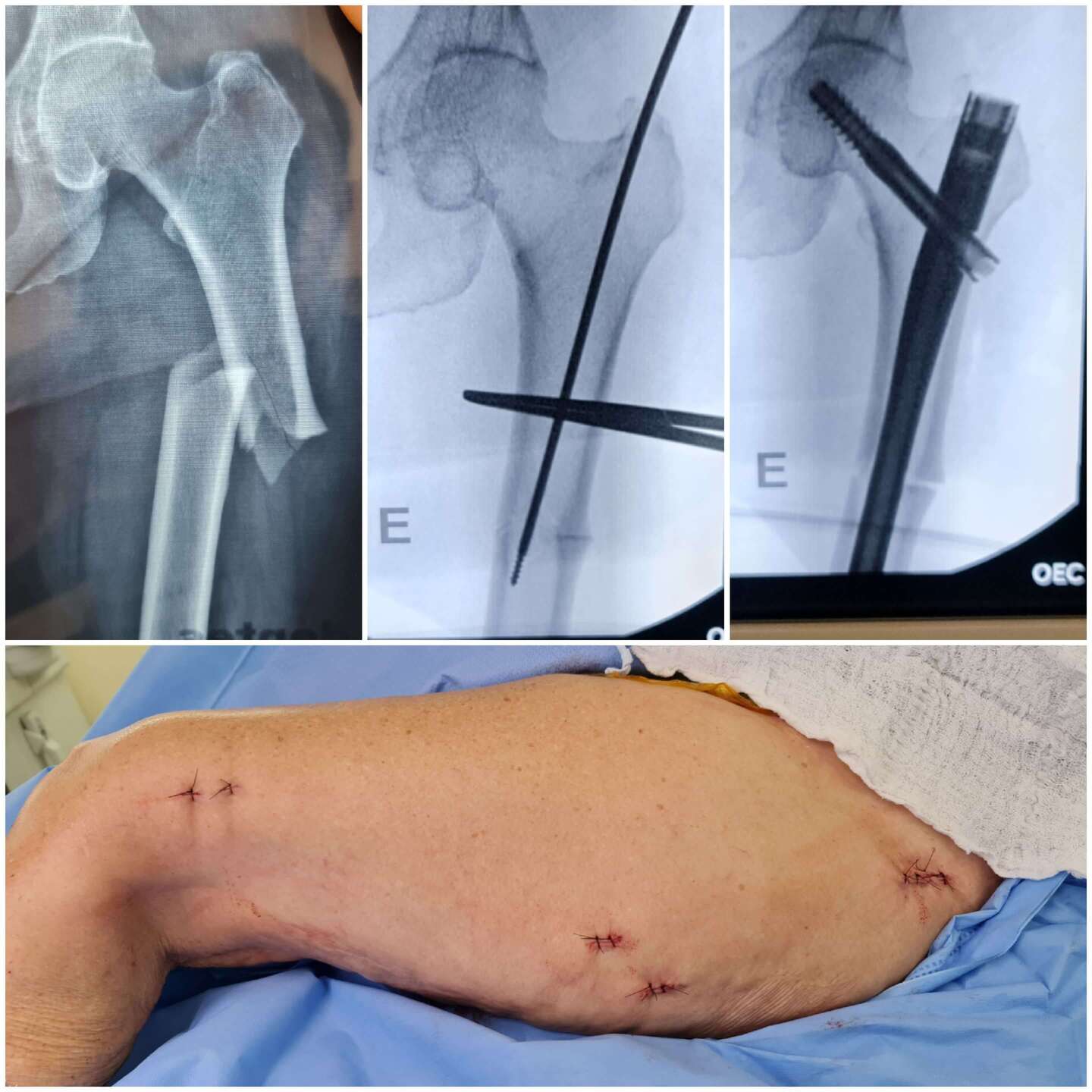 cirurgia-minimamente-invasiva-3