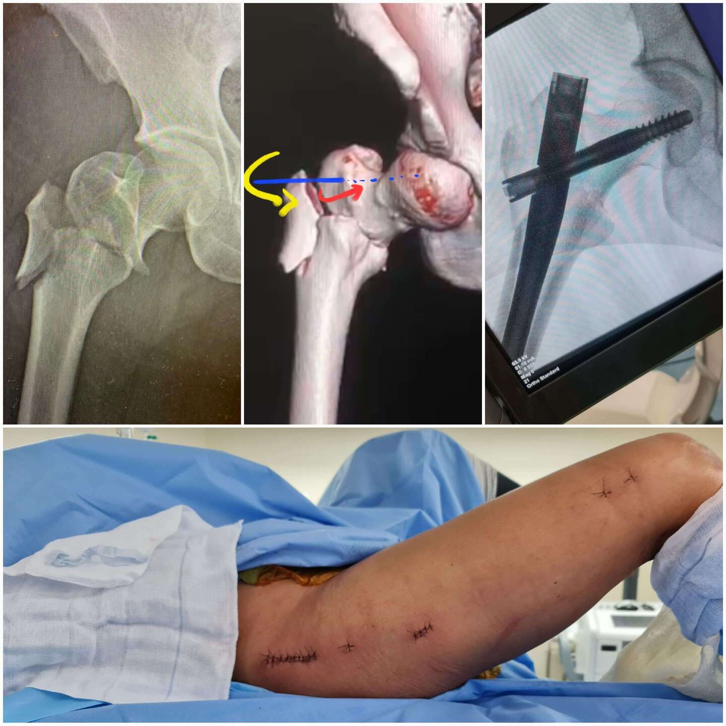 cirurgia-minimamente-invasiva-4